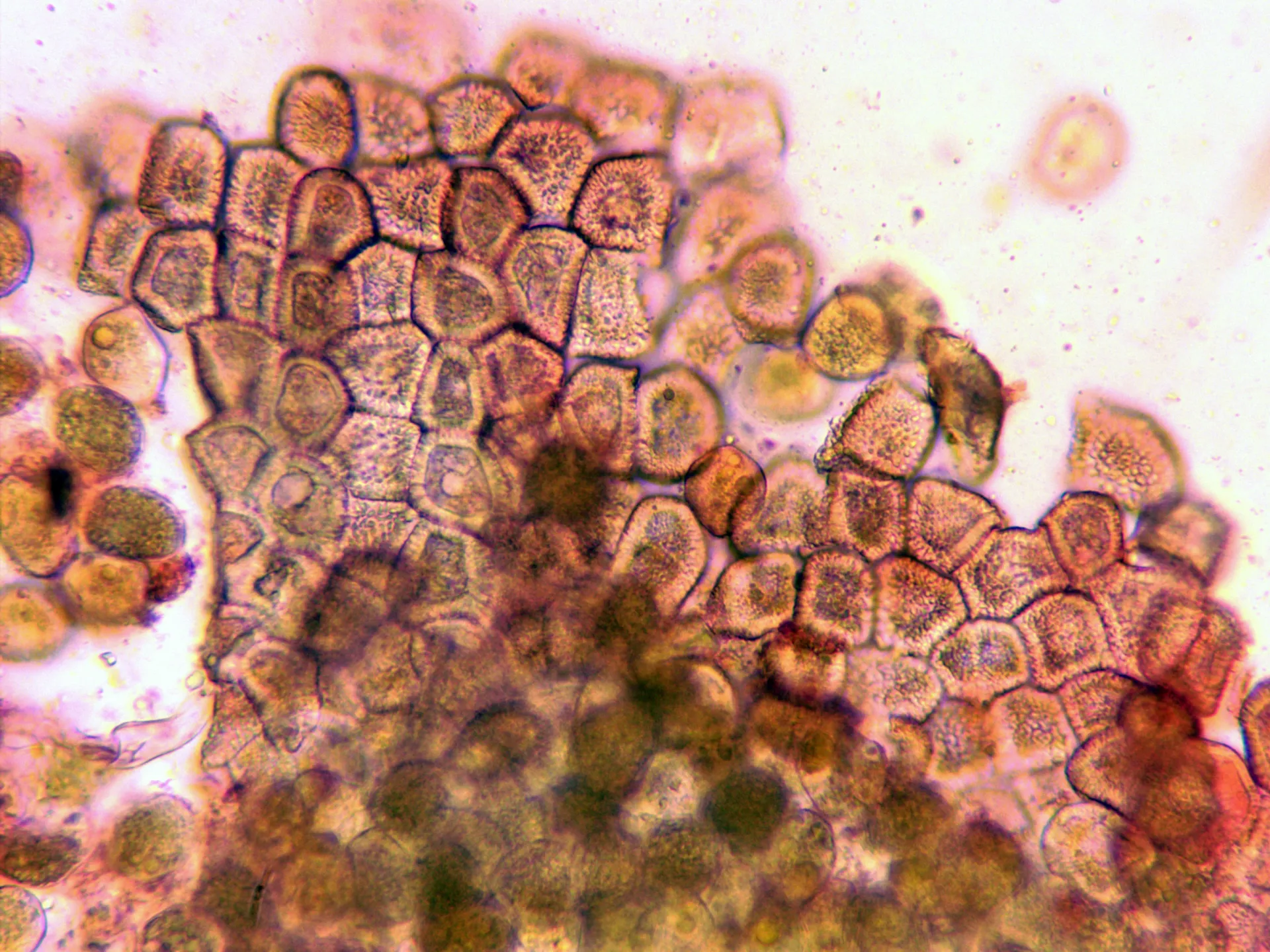 Microscopía de Puccinia convolvuli - 18 - Peridio X 400 Rojo